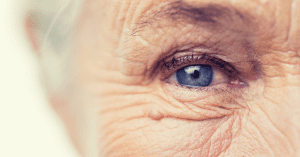 aging eye problems