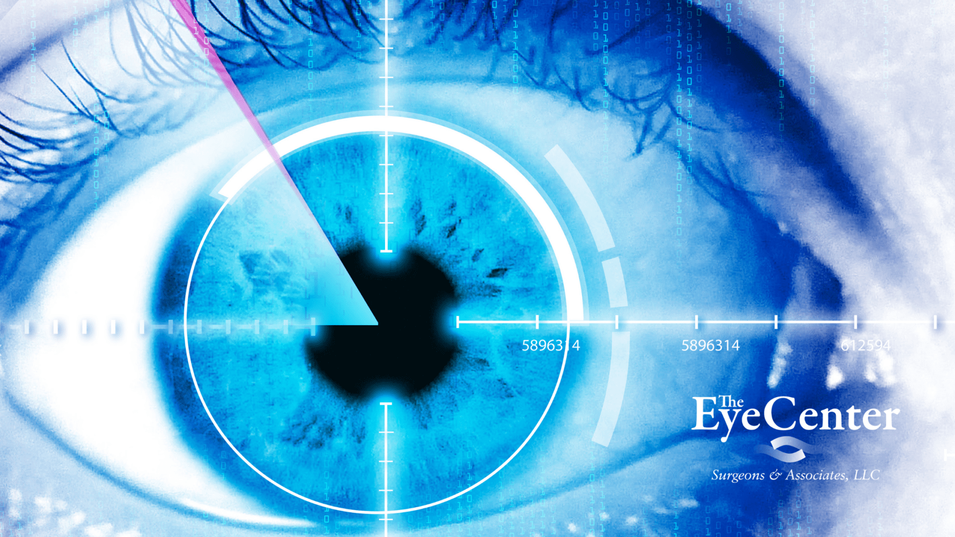 Close up of eye during LASIK surgery